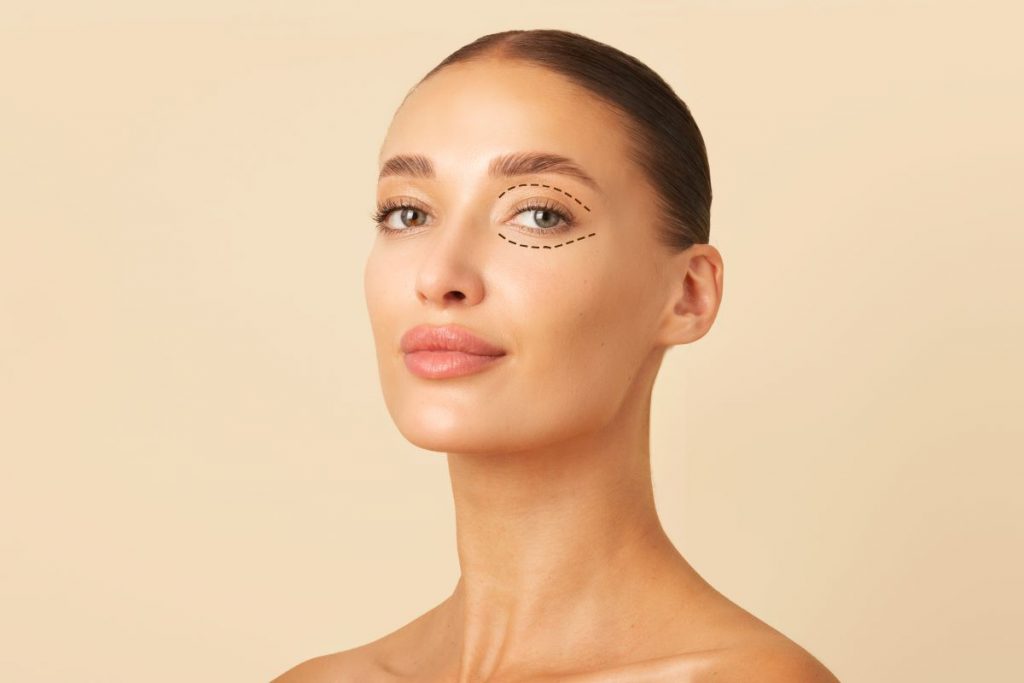 no-szemhejplasztika-kezeles-elott